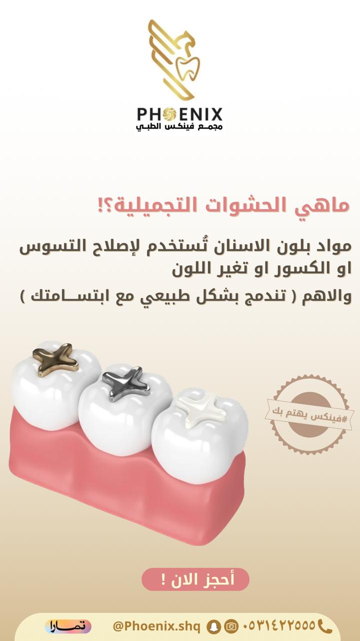 الحشوة التجميلية